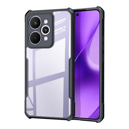 Realme15 Pro XUNDD Case